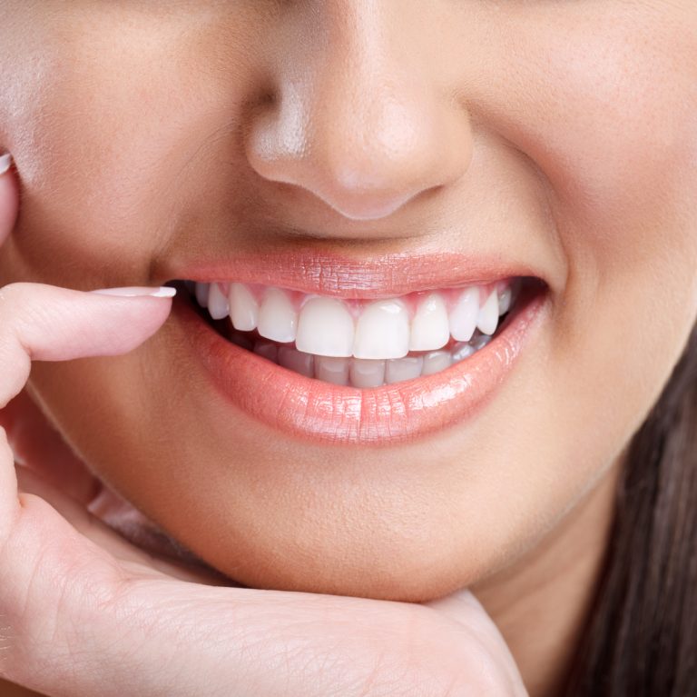 Teeth Whitening dental care